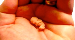 stellamatutina-feto-nella-mano-no-aborto